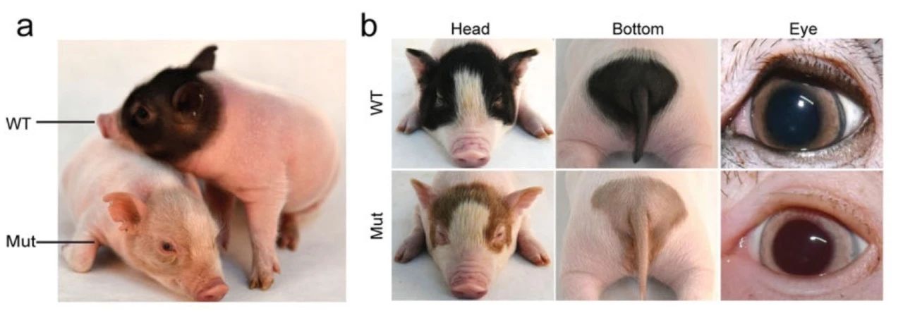 白化病治疗成功案例,白化病基因治疗最新突破