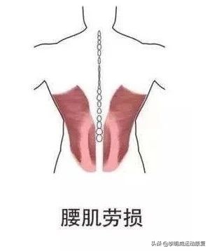 腰痛了最快恢复方法,你的腰还好吗是什么意思
