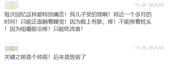 屏障受损起闭口粉刺多长时间能好,不要小看了闭口粉刺