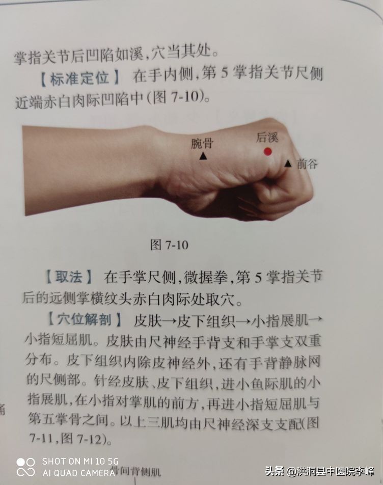 常见痛症“针刺运动疗法”特定取穴