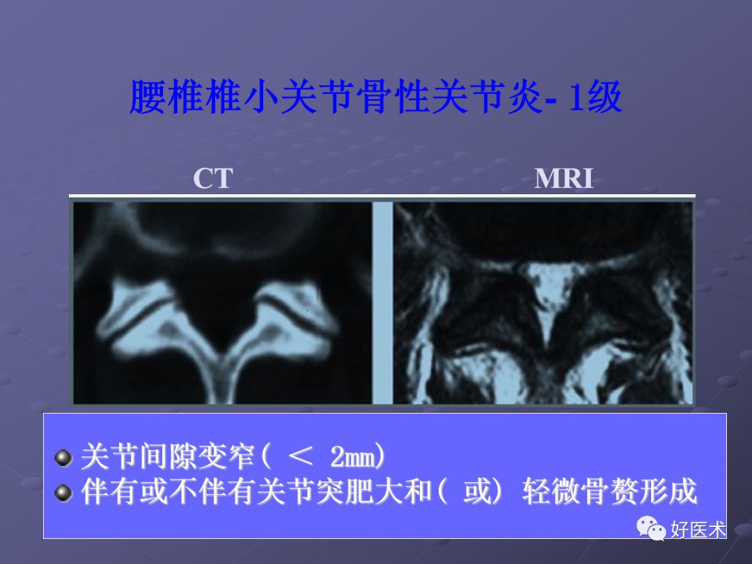 脊柱mri有哪些特点,乳腺疾病的mri诊断及鉴别