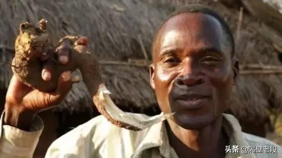 熨平少女胸部!揭秘非洲可怕习俗“烫乳”