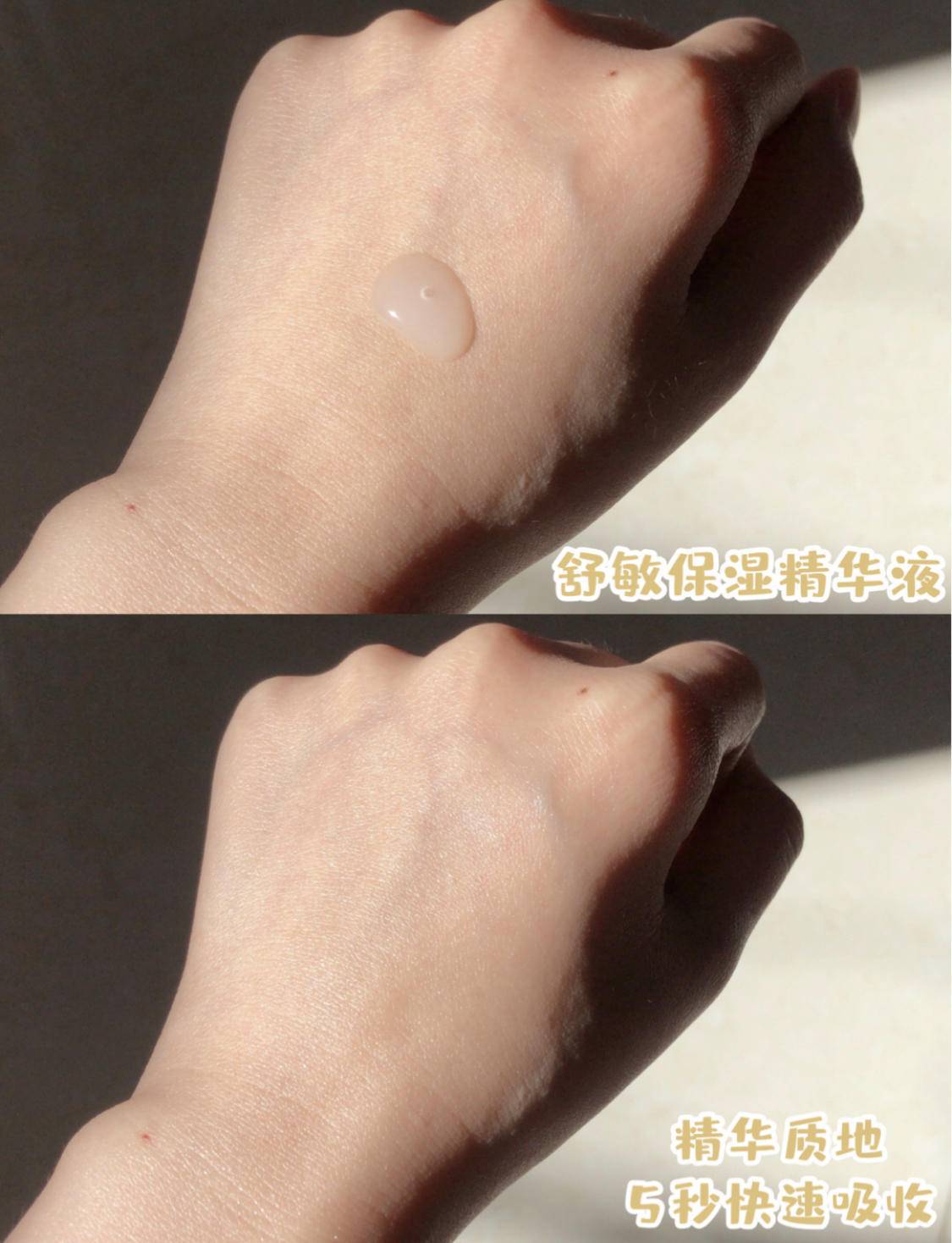 敏感肌肤抗衰产品推荐女,好物推荐敏感肌精华