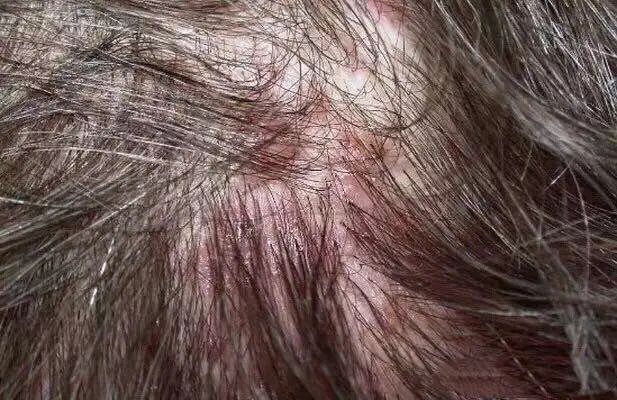 脱发掉发教你一招马上生发,了解头发脱发的书籍