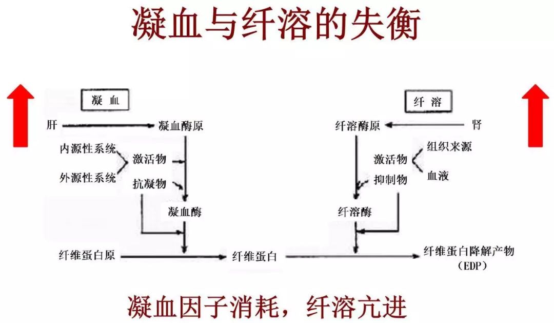 静脉血栓栓塞症发生的3个要素,静脉血栓十大抗凝误区