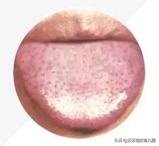 舌苔厚腻微黄中间有裂纹有红点,宝宝舌苔厚白嘴里有味怎么处理