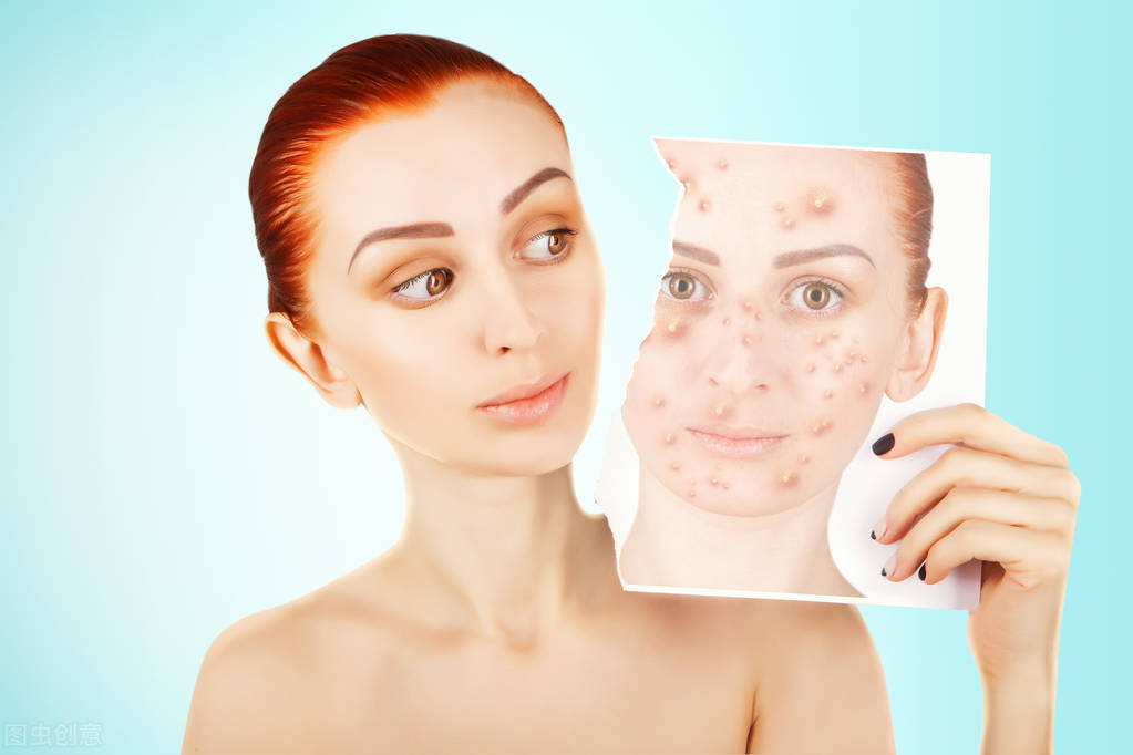 脸上长痘脖子也长痘是什么原因,起痘痘的地方反复长痘是什么原因