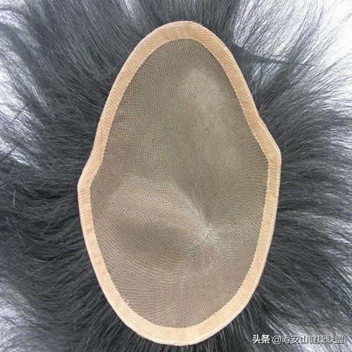 头发少是植发还是接发比较好看,植发与织发的区别