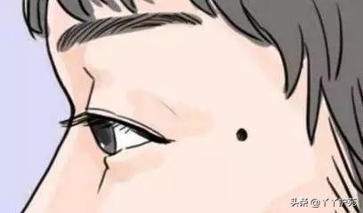 有黑痣不要慌教你一招,黑痣出现10个危害大