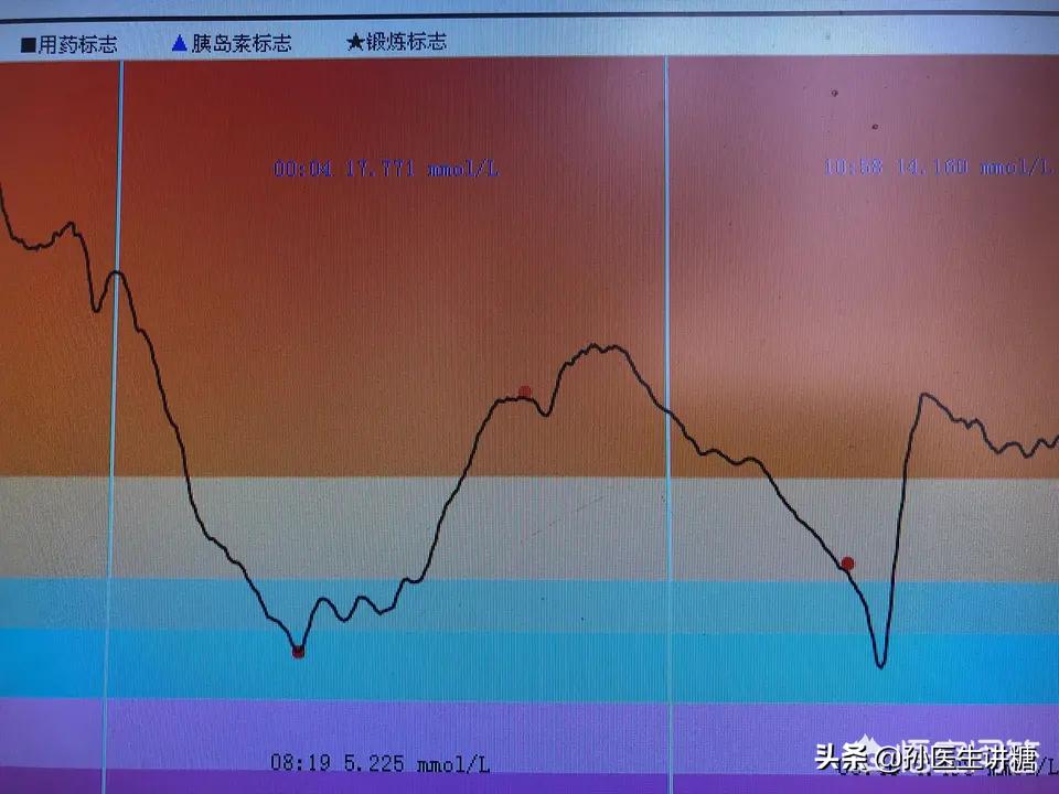 扎手指测血糖手指一直很痛,扎手指测血糖为什么那么痛