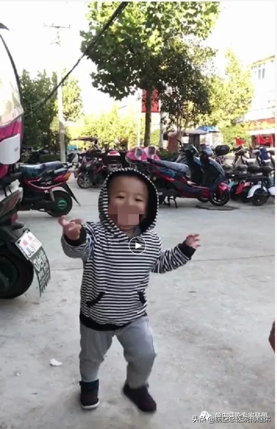 婴儿脑积水治疗方法动画演示,ommaya囊植入术是大手术吗