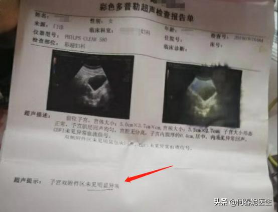 更年期月经紊乱病例,月经紊乱引起的闭经