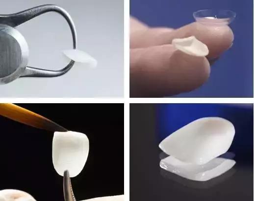 helen齿科黄璐,helen齿科