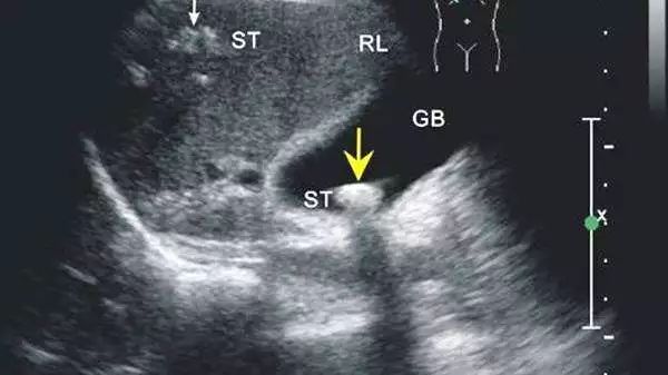 曝光现在体检行业乱象,体检行业黑幕后续