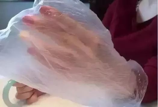 手镯长胖了脱不下来怎么办,长胖了手镯取不下来可以敲碎吗