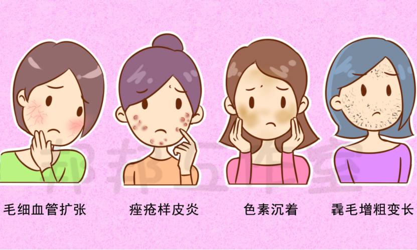 脚上用激素药膏会导致激素脸吗,激素脸形成的途径