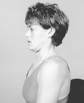 如何改善脖子向前倾,怎么改善脖子前后倾