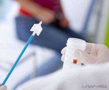 怎么看宫颈tct报告单,宫颈tct检查报告单是什么样的