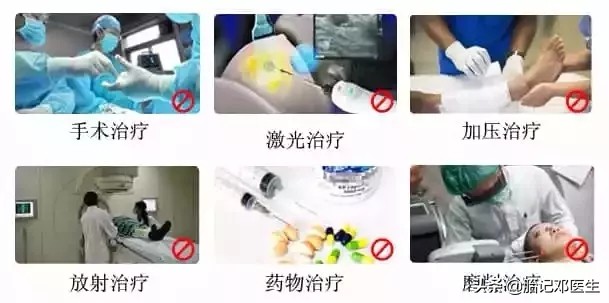 诊治咖啡斑你选对技术了吗,咖啡斑有药可治吗