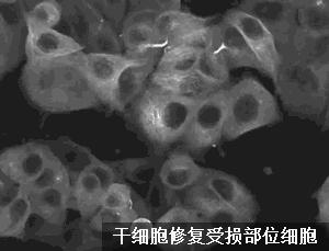 英超球队的体能训练,英超联赛为什么那么强调身体对抗