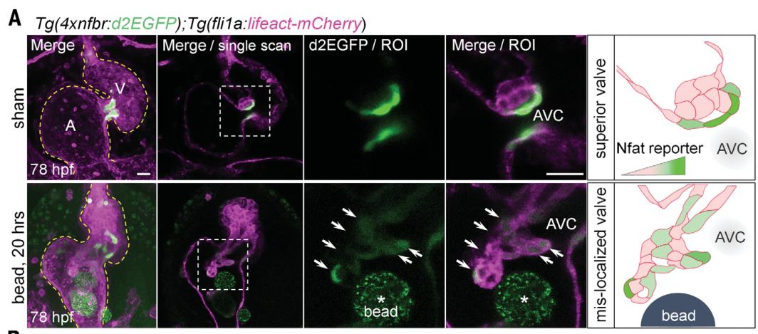 心脏机械瓣膜的工作原理,人工心脏瓣膜的产生与进展
