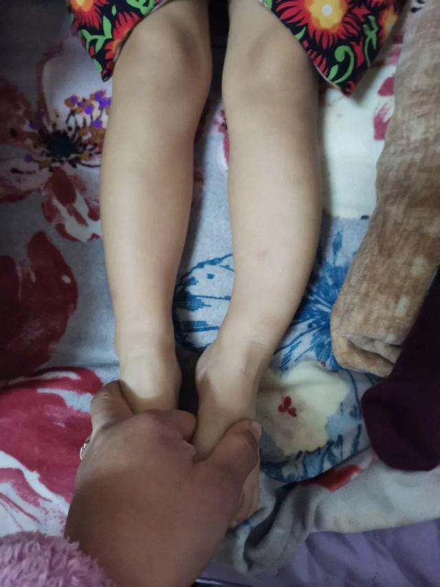 孩子o型腿可以自己绑腿吗,新生儿可以通过绑腿预防o型腿吗