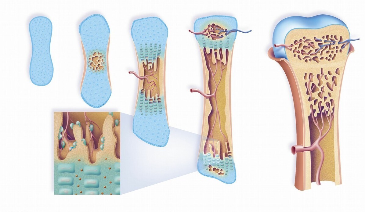 经常喝醋能导致骨质疏松吗,经常喝醋会造成身体有什么危害