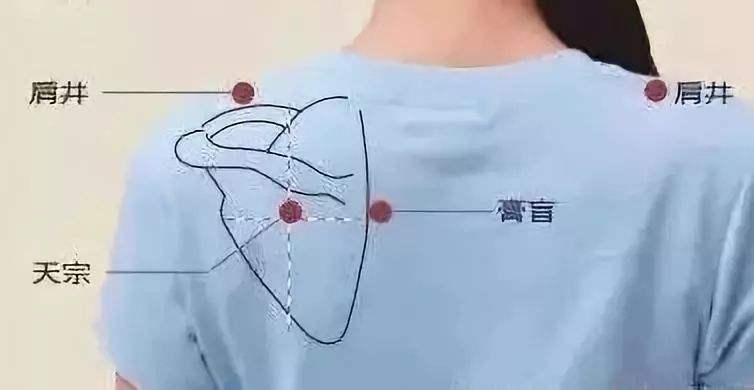 十大实用针灸穴位,针灸特殊穴位主治歌诀