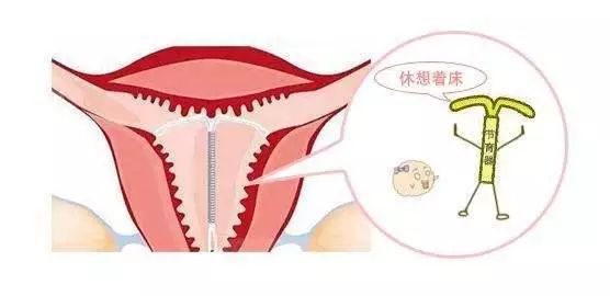 22岁女孩做6次人流,25岁女生人流两次