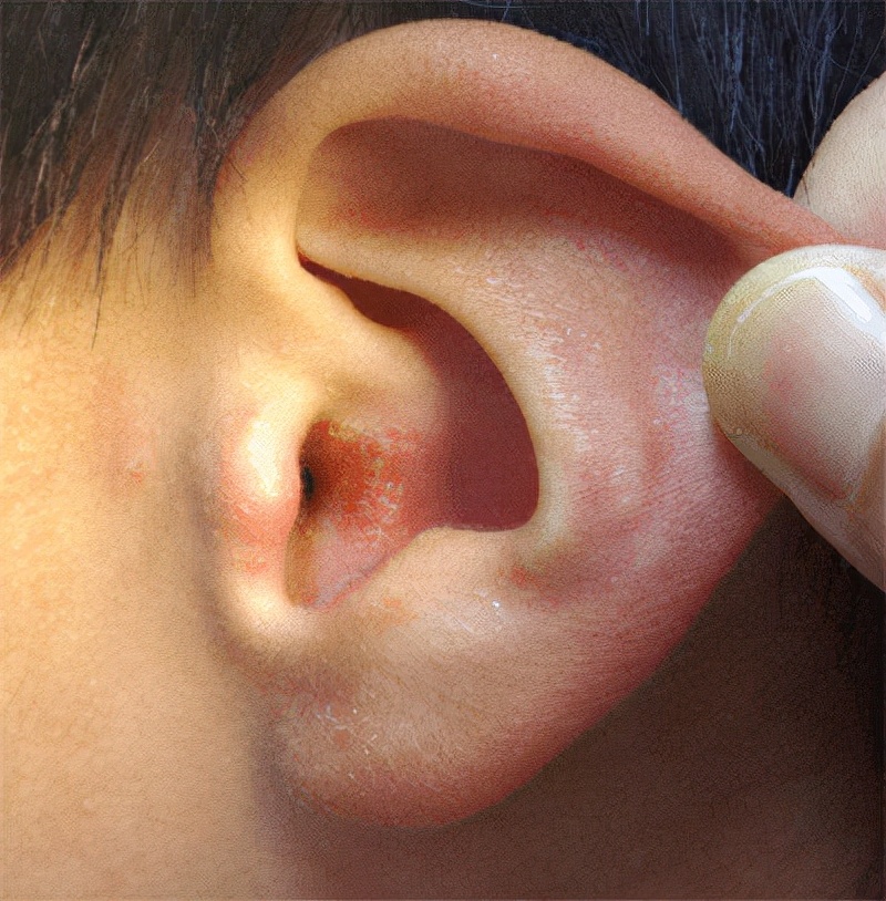 头戴式耳机对耳朵伤害更大吗,大耳机和小耳机哪个对耳朵好