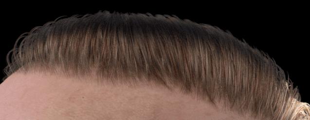 脱发过程3d动画,脱发有救了