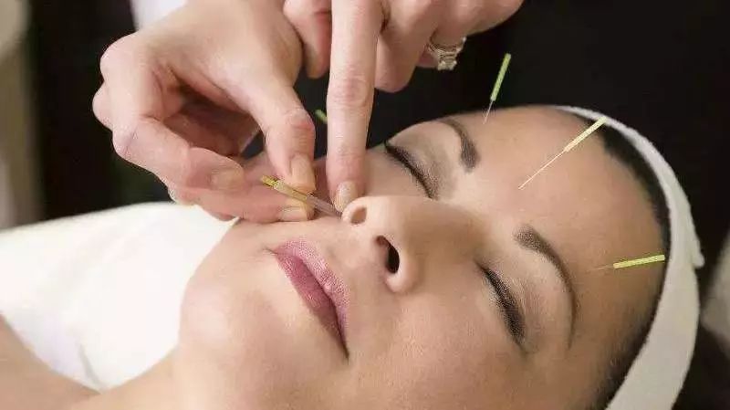 咨询有抬头纹法令纹鱼尾纹怎么办,去皱纹鱼尾纹法令纹抬头纹