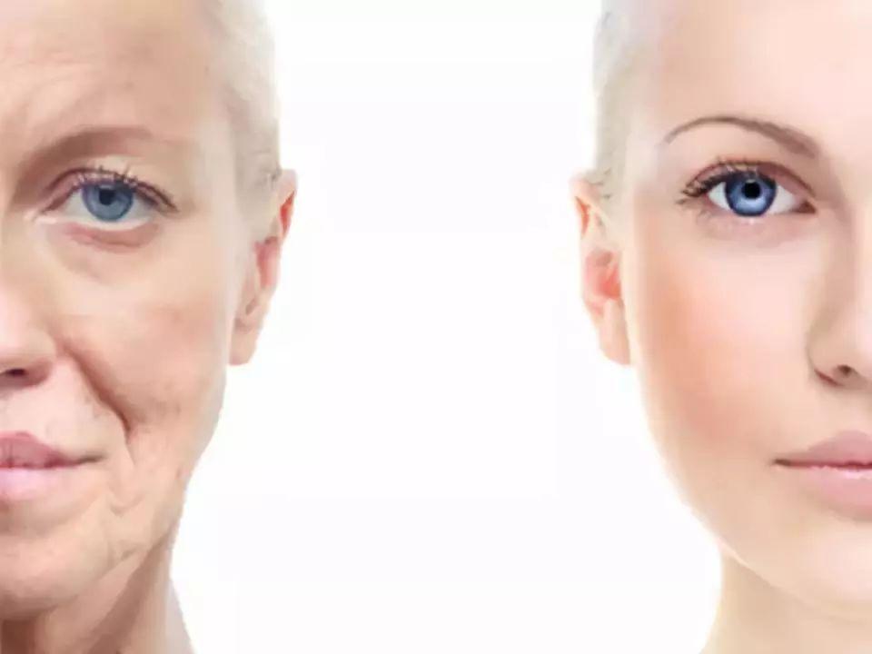 爱笑容易长法令纹,爱笑的女孩会长皱纹鱼尾纹法令纹