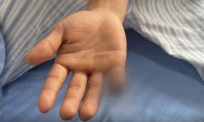 隔着屏幕都疼！抓捕“蛇头”过程中，他被咬断手指