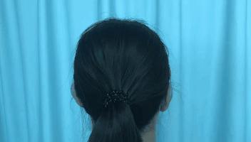 太秃头了怎么办,如何解决头顶秃