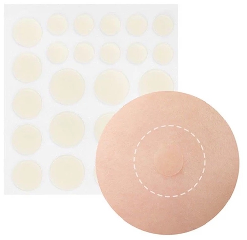 贴痘痘贴前要做好什么,痘痘贴怎么能贴牢