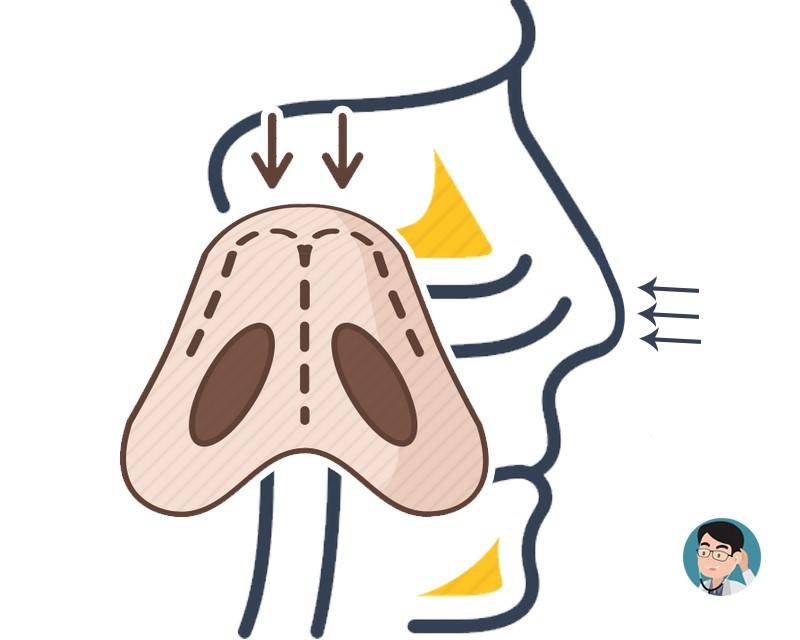 为何晚上比白天咳得厉害?医生:弄明白这个原因后,做2点可缓解