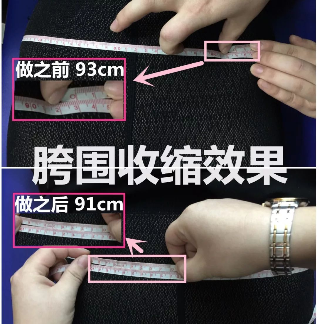 产后骨盆修复恢复多少厘米,产后盘腿坐对骨盆恢复有影响吗