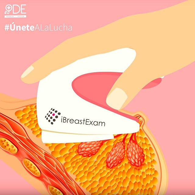 科技向善｜印度社会企业家为贫困地区女性发明廉价乳腺癌检测仪