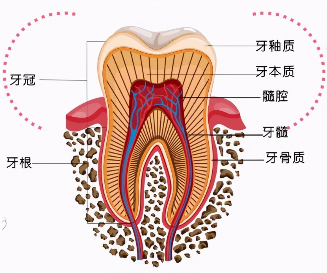 做了根管治疗后,该怎么选择牙冠?有哪几种修复方式可选?