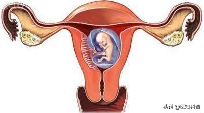 坐月子期间可能出现的问题,坐月子期间出现这些症状正常吗