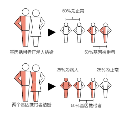 夫妻一方地中海贫血遗传几率,夫妻地中海贫血对胎儿有影响吗