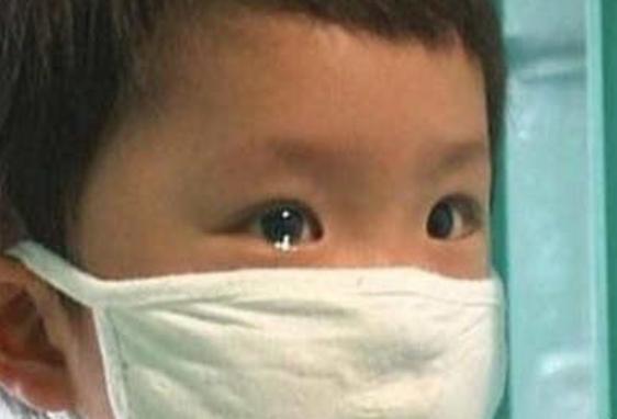 6岁小孩经常流鼻血是白血病吗,孩子一直流鼻血是不会得白血病啊