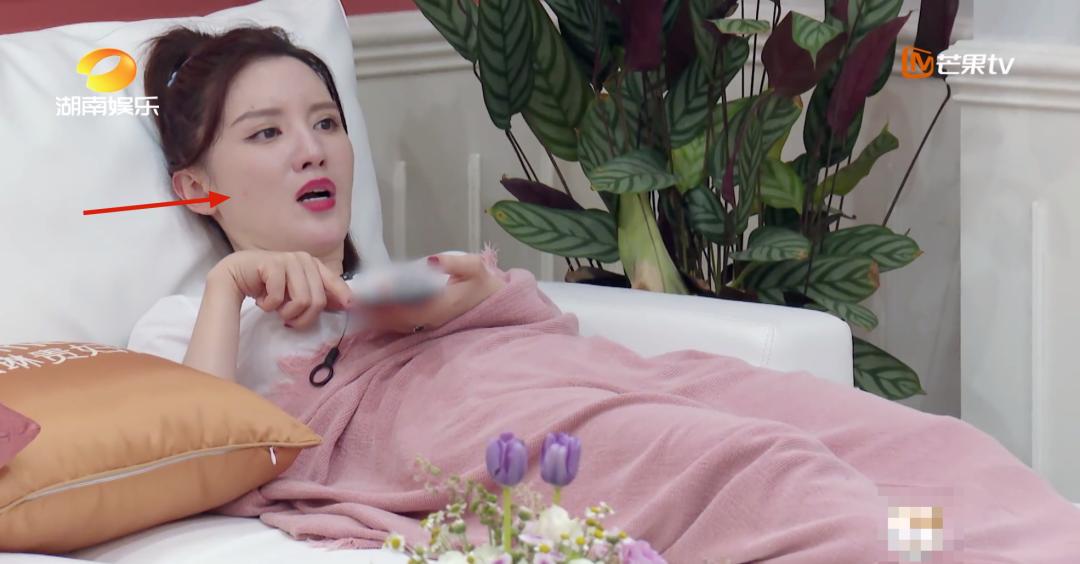 来月经的时候爆痘并且经量少,熬夜姨妈期爆痘怎么办