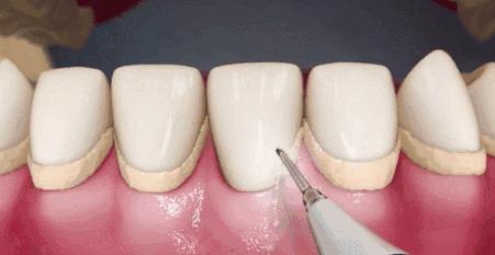 Helen齿科中心——口腔健康，从保卫牙周做起