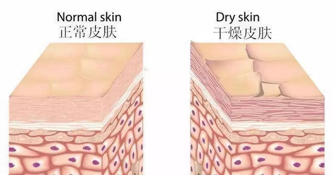 大干皮用的身体乳推荐,身上干皮用什么身体乳