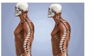 腰痛为什么会传到臀部,你为什么会经常腰痛