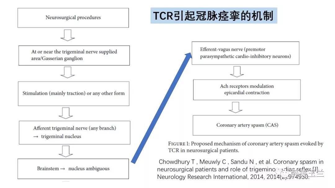 病例分享丨三叉神经节微球囊压迫术的麻醉管理