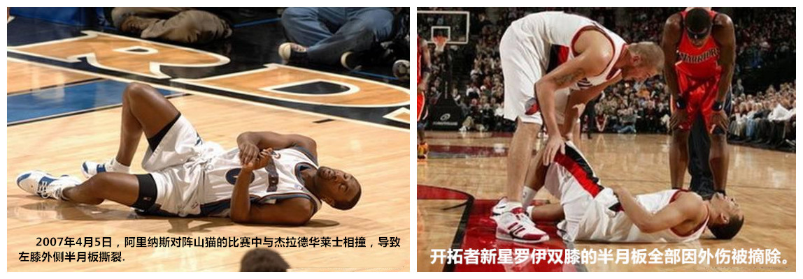 如何保护膝关节半月板,保护半月板的运动护具