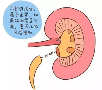 孕24周b超显示双肾,孕晚期b超显示左肾盂分离1cm